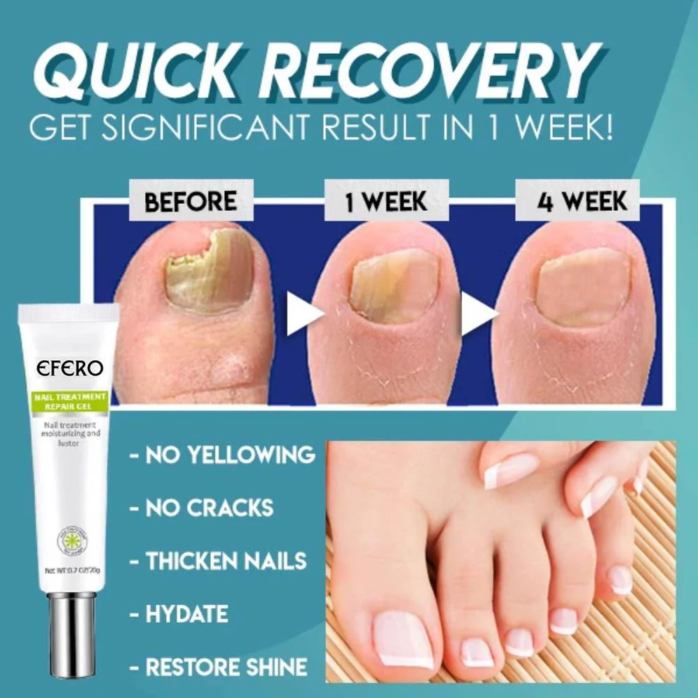 1+1 gratis | Nagelreparatie | Snelle en effectieve resultaten! - Image 2
