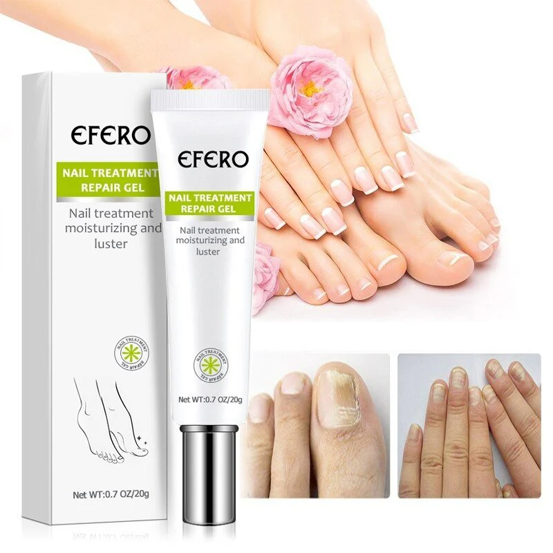 1+1 gratis | Nagelreparatie | Snelle en effectieve resultaten! - Image 3