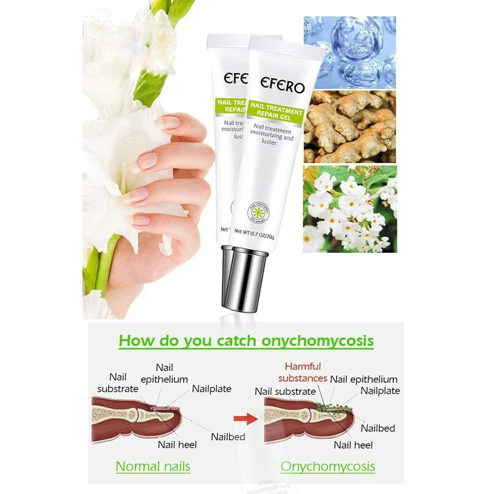 1+1 gratis | Nagelreparatie | Snelle en effectieve resultaten! - Image 5
