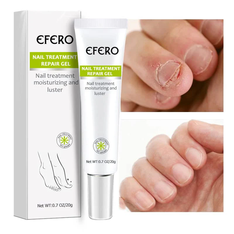1+1 gratis | Nagelreparatie | Snelle en effectieve resultaten! - Image 6
