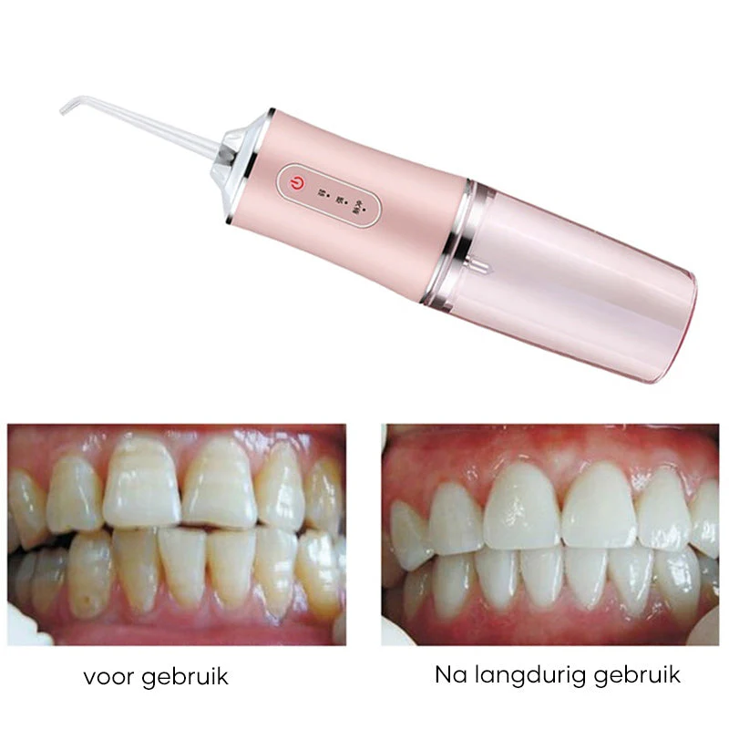 Draagbare tandheelkundige waterflosser - Image 11