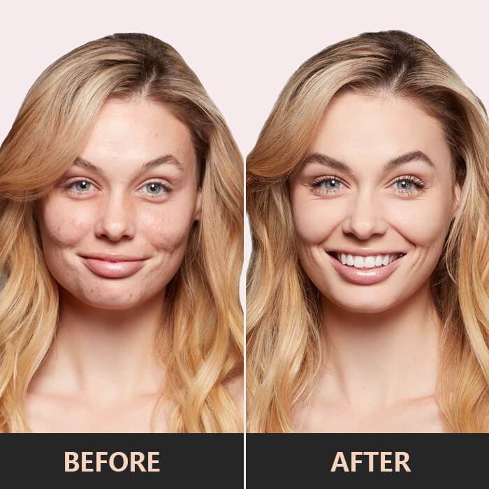 Driekleurige Concealer - Perfecte Kleurcorrectie & Huidverzorging - Image 3