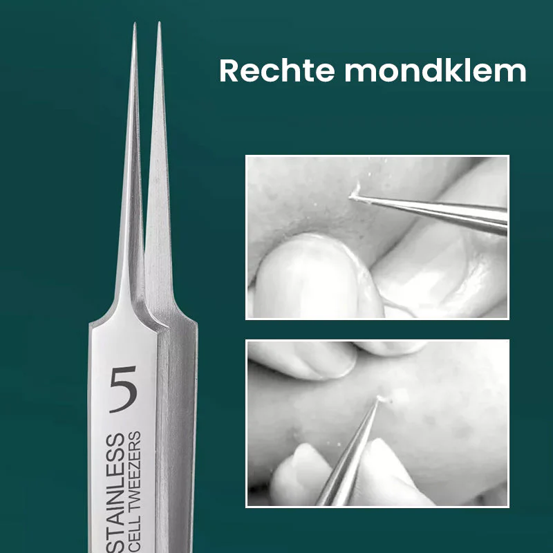 Duitse ultradunne mee-eter pincet - Image 5