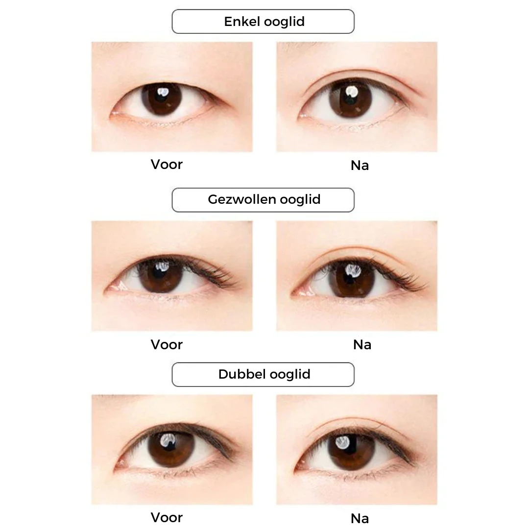 Manova™ EyeLifter - Onzichtbare natuurlijke ooglidstickers - Image 7