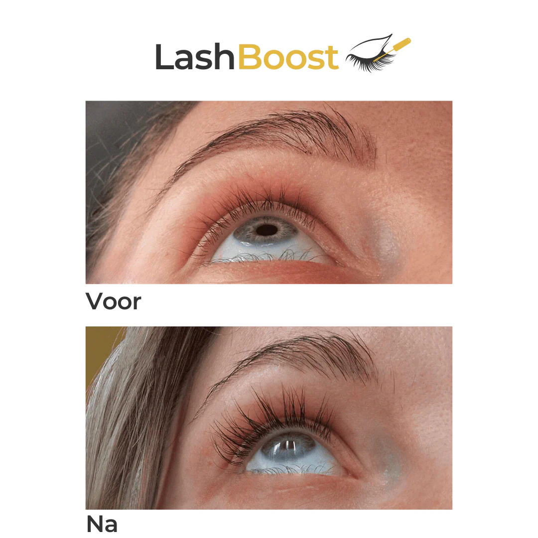 LashBooster ™ | Mooie & Lange Wimpers in enkele seconden| 1+1 GRATIS - Image 3