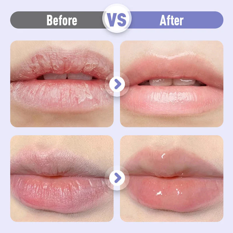 LushVive – Opvullend Lippenserum | 1+1 GRATIS - Image 11