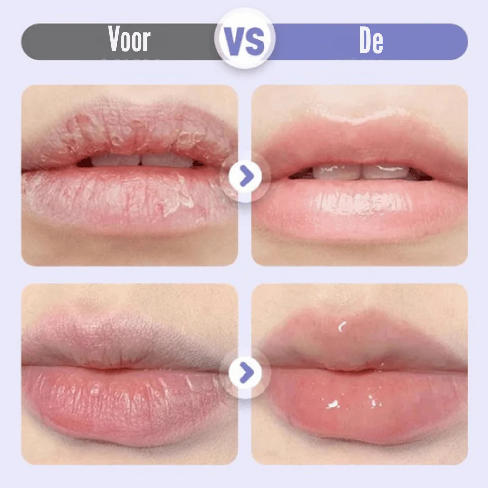 LushVive – Opvullend Lippenserum | 1+1 GRATIS - Image 3