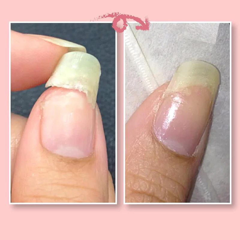 NAGEL REPARATIE BESCHERMENDE GEL - Image 3