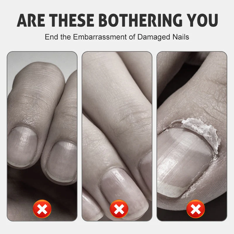 Nagelreparatie- en Versterkingsspray — Hydrateren, Versterken, Glans - Image 3