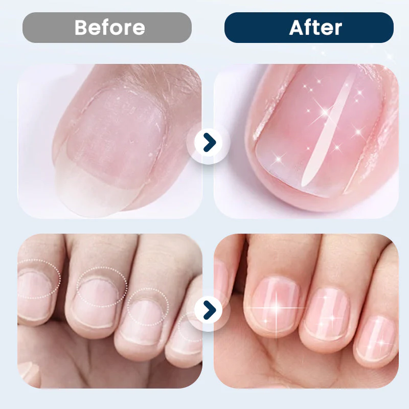 Nagelreparatie- en Versterkingsspray — Hydrateren, Versterken, Glans - Image 4
