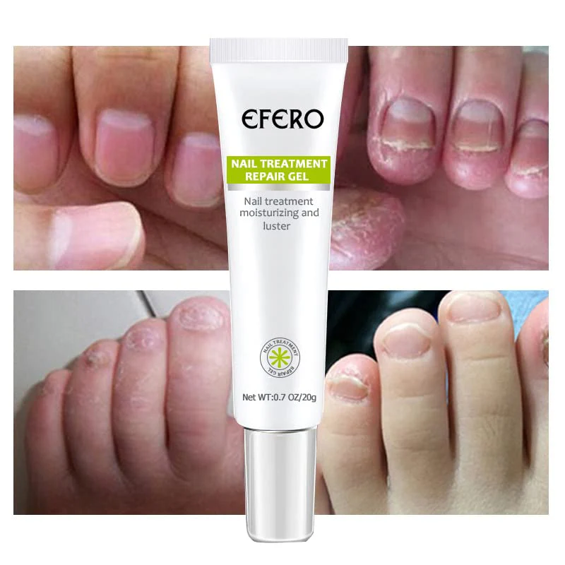 Nail Repair | Snel en effectief resultaat! 1+1 GRATIS - Image 5