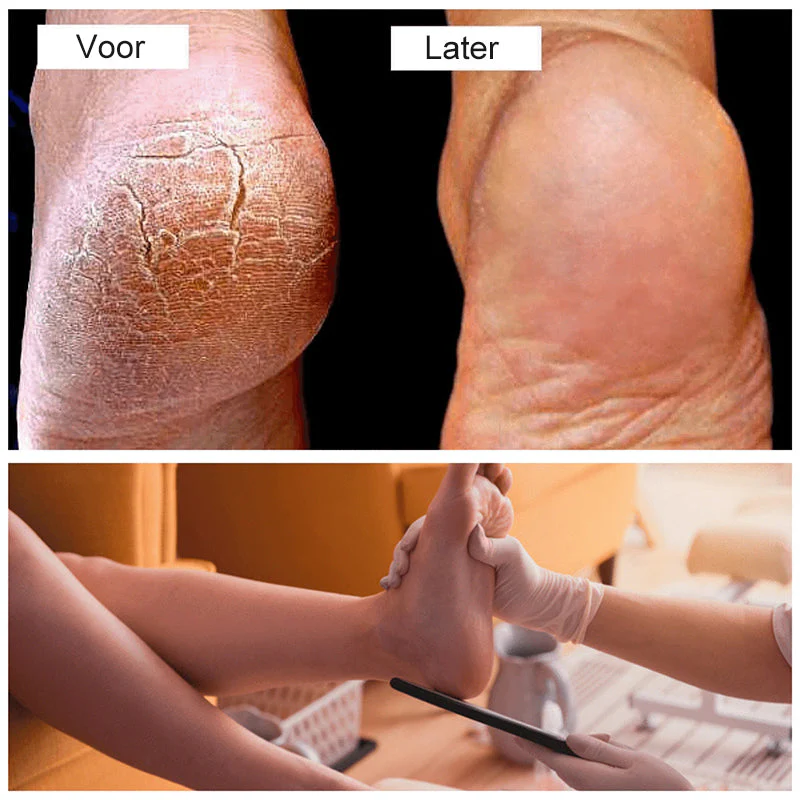 Pedicure  Voet Bestand - Image 4