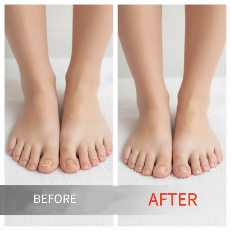 RevitaNail Repair Essence 30ml — Versterkt, Herstelt, Laat Glanzen | Koop 1, Krijg 1 Gratis - Image 2