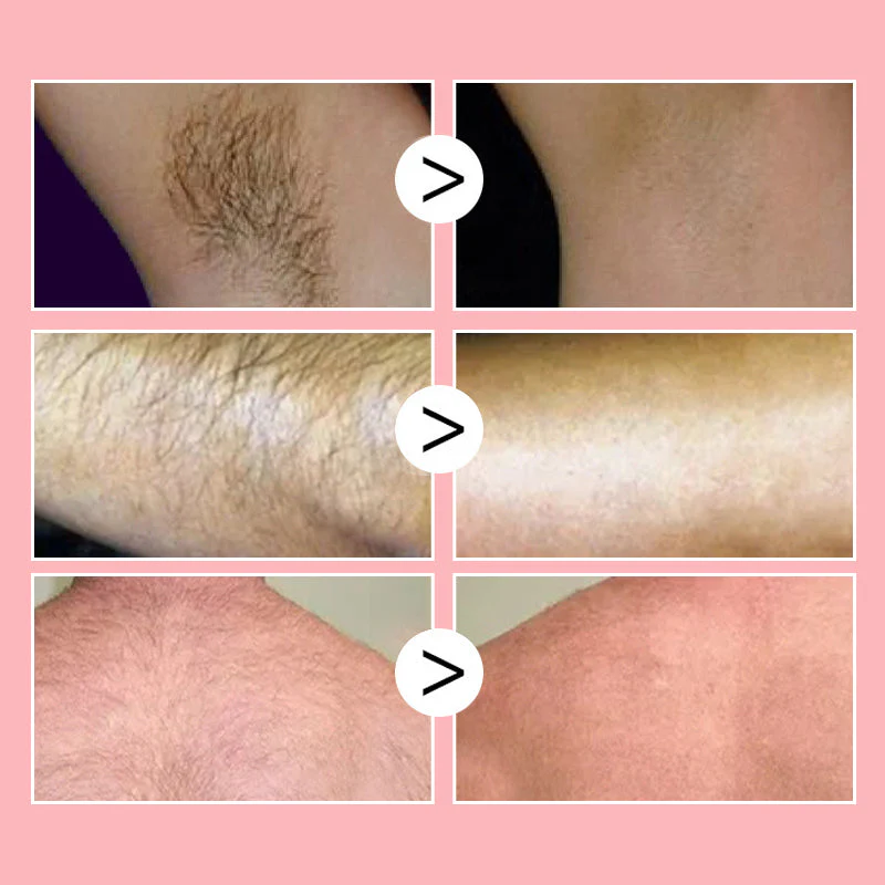 SilkBee 100ml – Honingmousse Ontharingsspray voor Zijdezachte Huid Zonder Irritatie | 1+1 GRATIS - Image 3