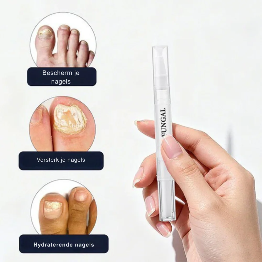 StrongNail – Precisie Nagelverzorging | 1+2 GRATIS - Image 4