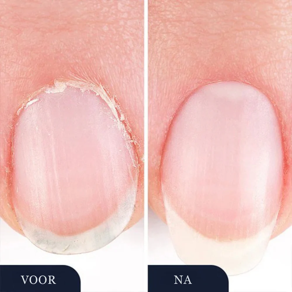 StrongNail – Precisie Nagelverzorging | 1+2 GRATIS - Image 5