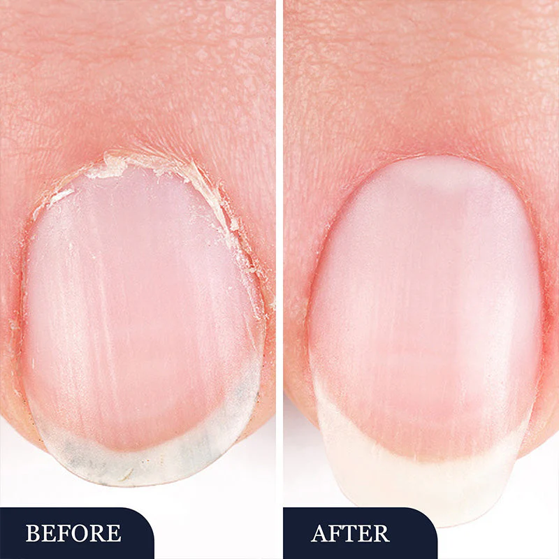 StrongNail – Precisie Nagelverzorging | 1+2 GRATIS - Image 8