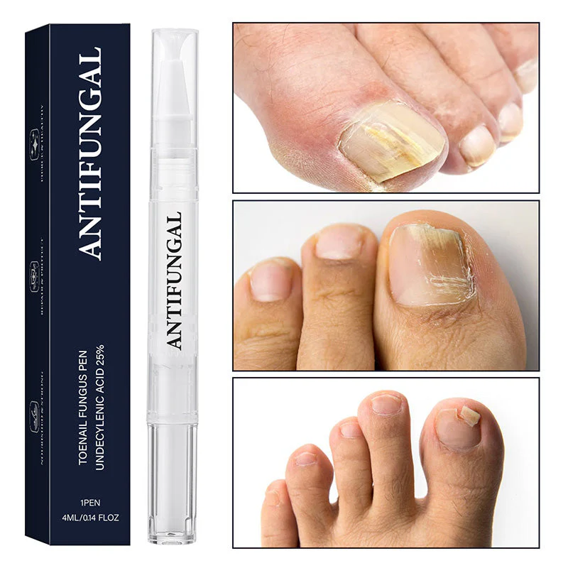 StrongNail – Precisie Nagelverzorging | 1+2 GRATIS - Image 9