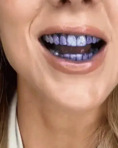 Tand kleur corrector - Image 6