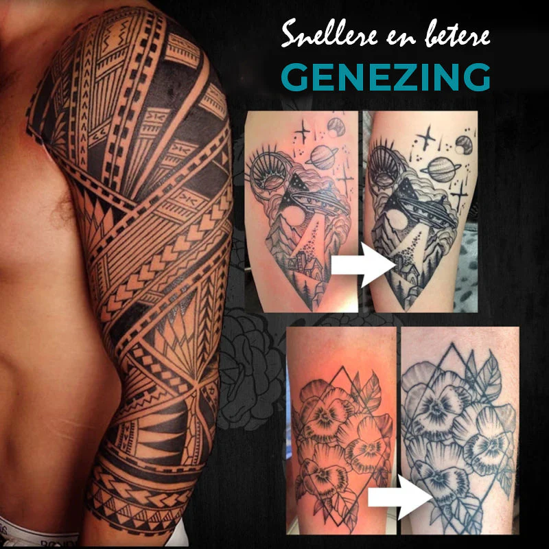 Tattoo Verhelderende Nazorg Balsem - Image 10