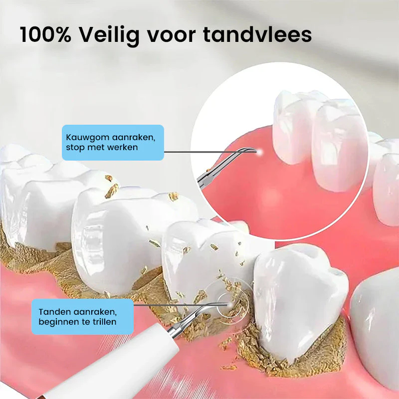 Ultrasone tandenreiniger - Image 8