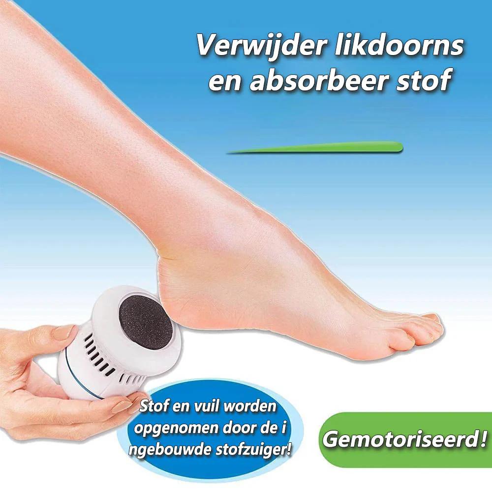 SoftFeet - Voetvijl en eeltverwijderaar | 50% KORTING - Image 3