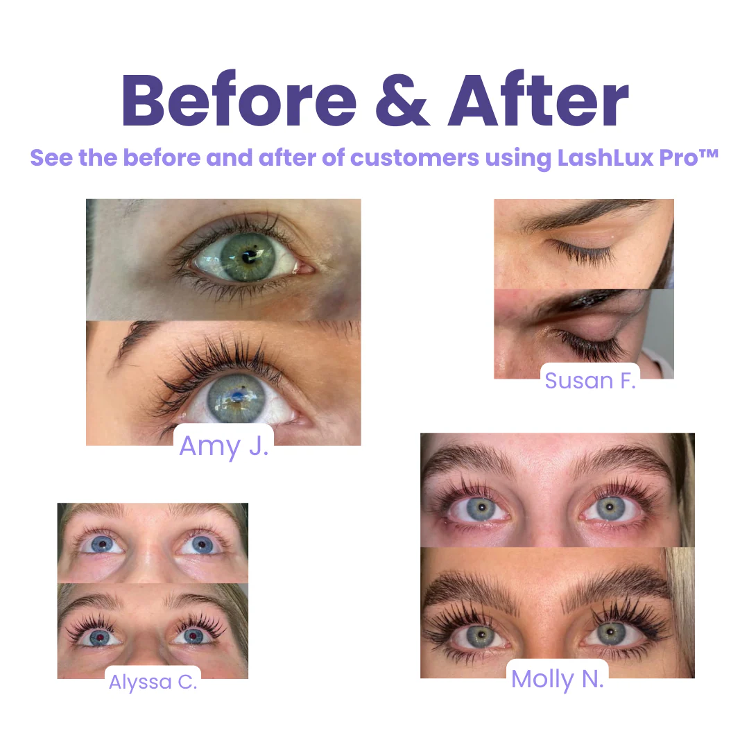 Wimpergroeiserum - Image 2
